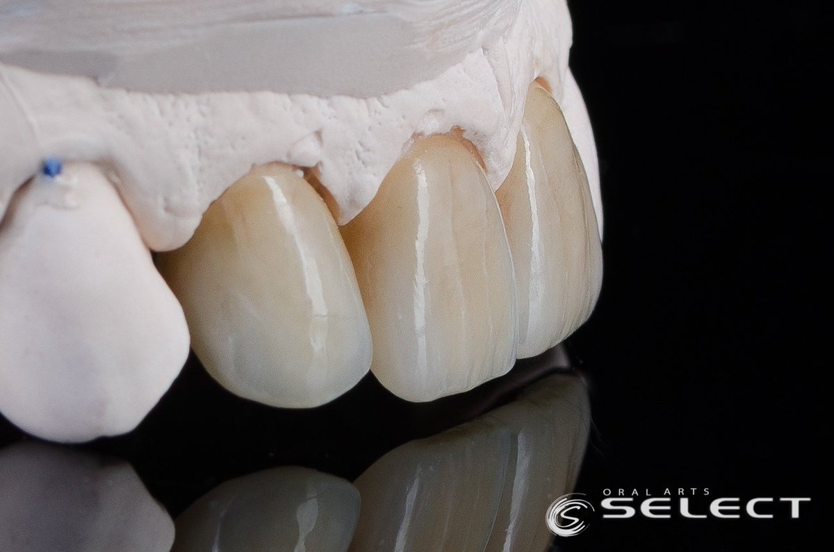 OralArtsDental's tweet photo. Amazing color and detail with these IPS e.max veneers. This patient will for sure be amazed by these results.
#OralArtsHuntsville #OralArtsDental #OralArtsHville #OralArtsDentalLab #OralArtsHSV #DentalLab #DentalLife #Dentistry #OralArtsSELECT #SmileMakeOver #IPSEMAX #EMAX https://t.co/1lZ4S9I1Xe