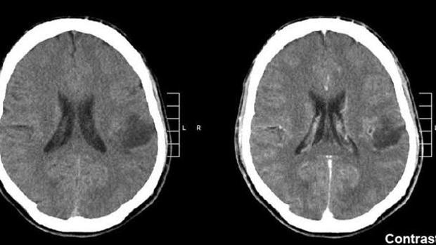 #12Jun BUENA NOTICIA | Investigadores españoles descubren un fármaco eficaz contra las metástasis cerebrales.

El medicamento se llama ‘silibinina’  y es capaz de reducir las metástasis en cerebro sin causar ningún efecto secundario.

Más información: bit.ly/2LFgdXJ