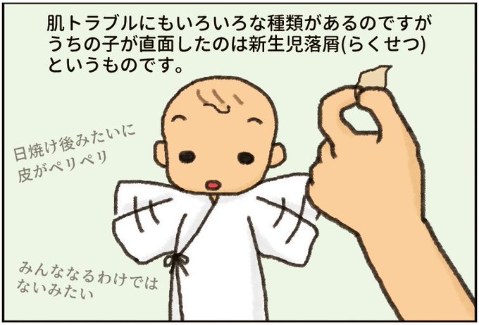 新生児 脱皮