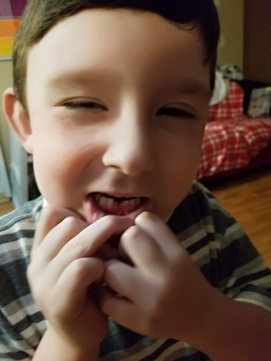 Jezinista's tweet photo. Well tooth came out... he hid his tooth in the kitchen.. he wanted to know what the tooth fairy looked like..... google was bad.. now he is terrified.  He is sleeping in my bed tonight lol #badgoogle https://t.co/qCt8STiJ5X