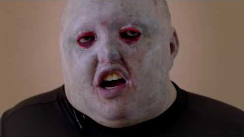 majke3_si's tweet image. is.gd/1dg42x #Bolezen #Diagnosys #DIAGNOZA #Eb #Raredesease #Skincondition #Video