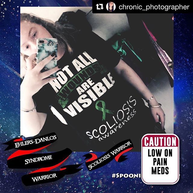 SpoonieApp's tweet photo. 💜✨🥄💜 #Repost @chronic_photographer
・・・
Fact: did you know that even a slight curve can cause pain? June is scoliosis awareness month, bring your green out!💚 #scoliosis #scoliosisawareness #green #ehlersdanlossyndrome #edsawareness #hEDS #edsaware… https://t.co/UHq8pRv9xQ https://t.co/tT8JKVXbZi