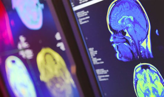 digitisationjob's tweet photo. Harry Evans: Realising the future of #DigitalHealth and #AI in health care. #Digitisation of electronic patient records, collecting health #Data &amp; #MachineLearning-algorithms as the brains of #NHS #DigitalTransformation 🧠 https://t.co/e16IxKVZzP @TheKingsFund https://t.co/O44xHWvVay