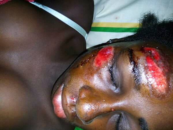 Expertsantes's tweet image. violence faites aux travailleuse de sexe ce vendredi a nkongsamba @AfricaSexWork @redumbrellafund @alcondoms @Camer24