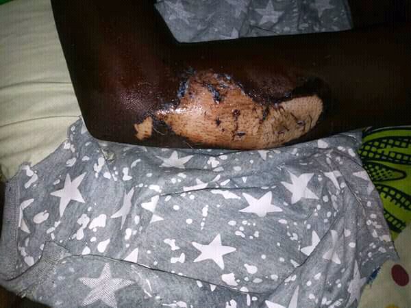 Expertsantes's tweet image. violence faites aux travailleuse de sexe ce vendredi a nkongsamba @AfricaSexWork @redumbrellafund @alcondoms @Camer24