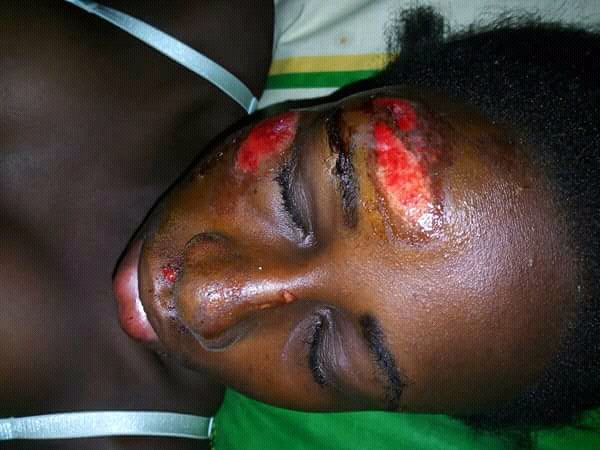 Expertsantes's tweet image. violence faites aux travailleuse de sexe ce vendredi a nkongsamba @AfricaSexWork @redumbrellafund @alcondoms @Camer24