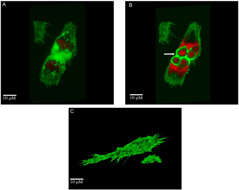 Immunology2018's tweet photo. #Celltocell spread and #massive_vacuole formation after Cryptococcus neoformans #infection of murine #macrophages
https://t.co/EQwy1NJD20
#submit your #abstract at
https://t.co/3VAjvEmM43
#immunologyconferences #molecularimmunology #vaccineconferences #microbiologyconferences https://t.co/5owLnAB7Ol