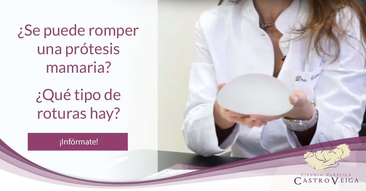 CPCastroVeiga's tweet photo. ¿Se puede romper una prótesis mamaria? ¿Sabes qué tipos de roturas hay? La Doctora Castro nos resuelve estas y otras dudas. Pero estate tranquila , aunque se rompiera tu prótesis, tu salud no correría ningún peligro. ¡Sigue informándote! https://t.co/rhwaBPlnH5  #protesismamaria https://t.co/2nJriznM8A