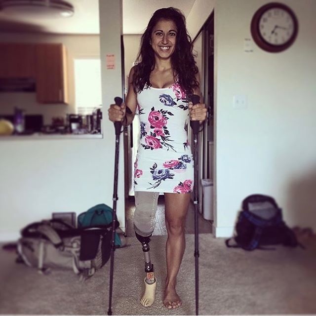 AdaptiveAmputee's tweet photo. Read about tips &amp; tricks for amputees to get active (link in bio)
_______
#amputee #livewolimbs #amputeegirl #amputeelife #amputeemodel #adaptiveathlete #handicapped #disabled #disableyourlimits #girlswhohike #outdoorwomen #optoutside #optoutside🌲 #e… https://t.co/rFv1nQd96L https://t.co/Z78ZDvWOHM