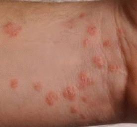 BMJLearning's tweet photo. Hospital presentations: rash - our latest module covers recognition, assessment, and management of common skin conditions https://t.co/nxEszJGSrv #rash #CMT #medtrainees #meded #dermatology https://t.co/MWchV51LL5
