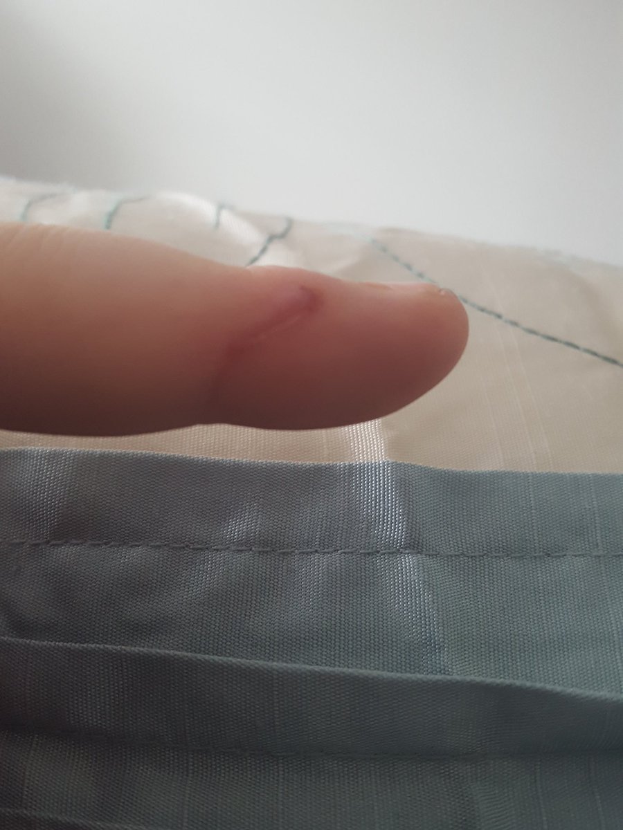 miffyx1631's tweet photo. I sliced through my finger quite deep and it hurts like a bitch and won't fuse properly.
Only stopped bleeding today.
Someone send money  to my paypal so I can buy pizza to cheer me up.
@rtfemdom1 @RT4D1 @rt_feet @RT4FD @RTxxlslave @RTABDL #findom #efdp #sph #paypig #abdl #ddlg https://t.co/IM1cndK3bK