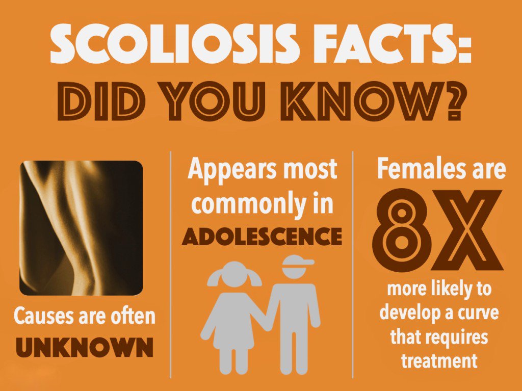 June is Scoliosis Awareness month! These quick tips will help you know what signs of scoliosis to look for in adolescents and infants. #scoliosisawareness #spinaldoctor #scoliosisawarenessmonth spinaldoctor.com/blog/2018/06/1…