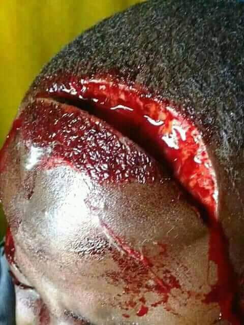 This is how how people (including children and ladies) are being butchered in Southern Cameroons everyday
#bbcnews #cnnireport #AlJazeera @innercitypress @dwnews