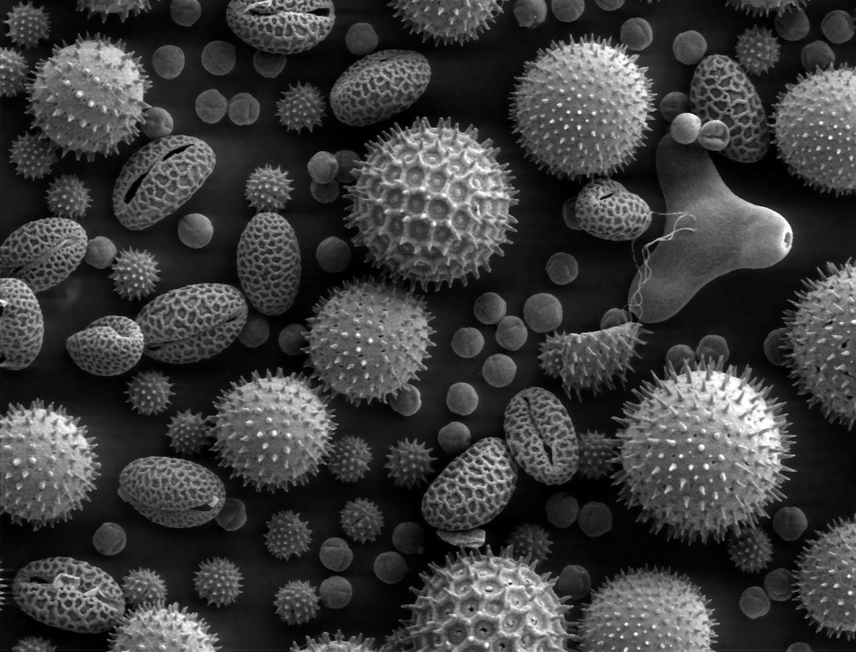 editor_microsco's tweet photo. #Microscopy defined as a #techique to #visualise the #minute #objects that are  not #visible through #naked #eye. #Light and #electron #microscopes are used  to #examine the #biological #specimens for #celluar details https://t.co/YrrCxkG2A4