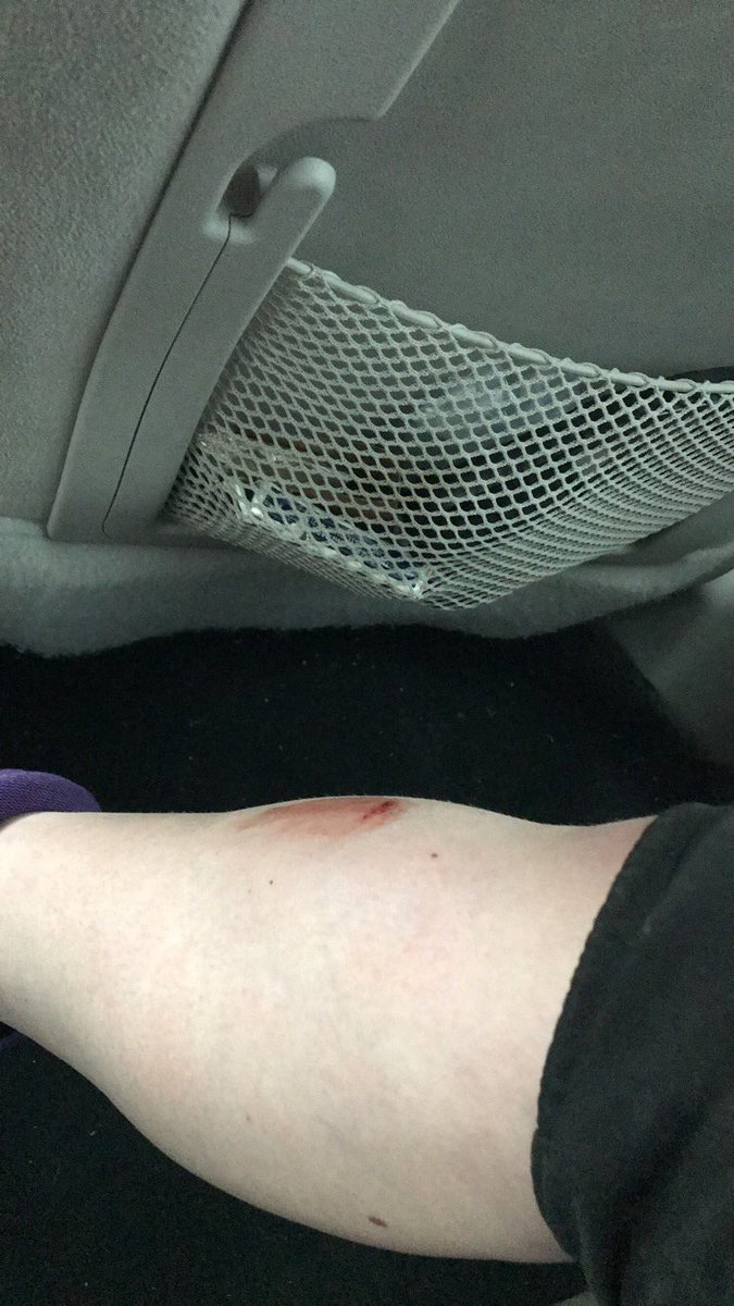 csellers10's tweet photo. happy national softball day !! thanks for all the bumps and bruises !! #nationalsoftballday https://t.co/yFBWfTCClk