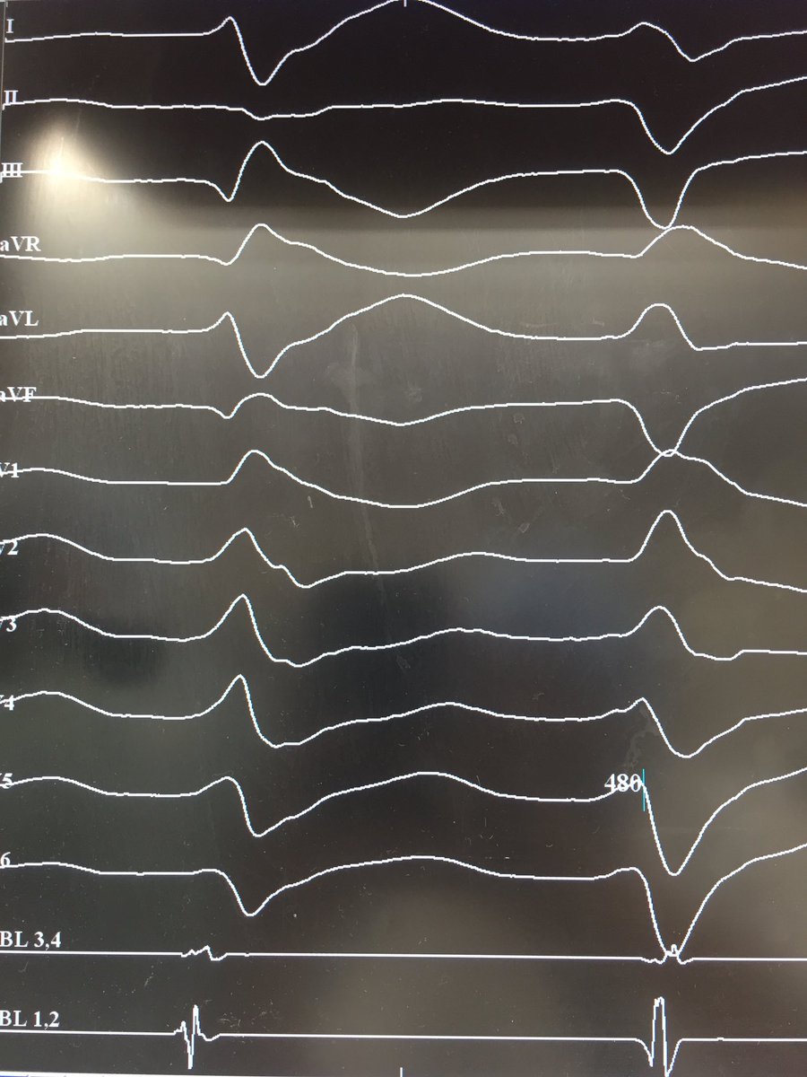 Kanwar Y. Singh tweet media