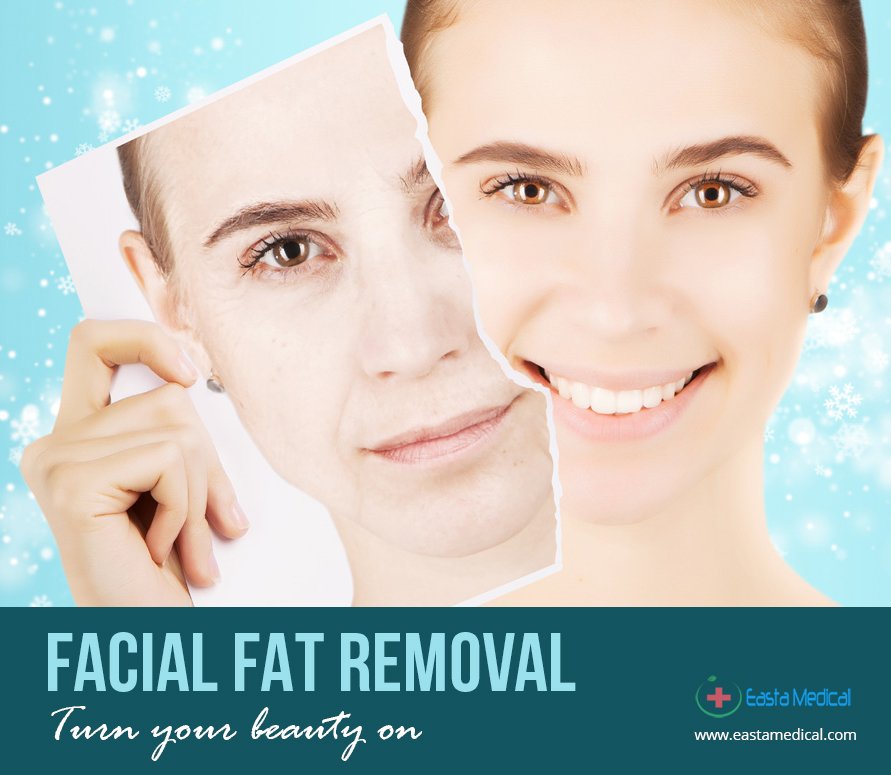 eastamedical1's tweet photo. Know more: https://t.co/gokWIvNmp3
#FacialFatRemoval #DoubleChinSurgery
#FatGraft #StarLifting #eastamedical
#FacialBoneContouring
#TenLifting #PRP
#ThreadLifting #BeautifulFace
#BeautifulGirl #ReshapeYourBeauty
#NewTrend2018 #Lifestyle2 https://t.co/t8VshDEJGO