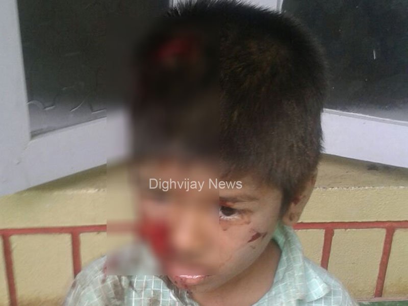 Vijayavani_Digi's tweet image. ಬಹಿರ್ದೆಸೆಗೆ ಹೋದ ಬಾಲಕನ ಮೇಲೆ ಹಂದಿ ದಾಳಿ
#PigAttack #Boy #Alvarnava
goo.gl/A7zs2r
Dighvijay news live app-qvqw7.app.goo.gl/naxz
Dighvijay news live website-dighvijaytv.in