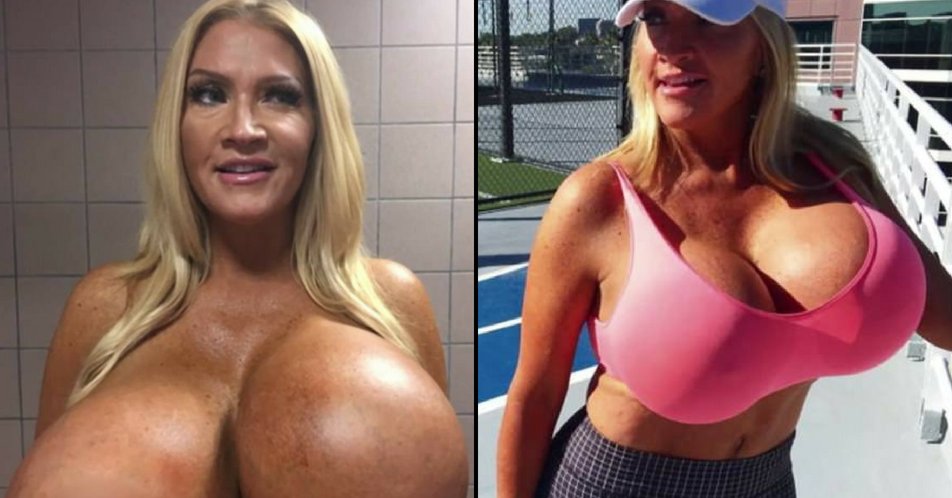 LADbible on X: Woman who self-inflated breast implants is left with  massive lopsided boobs.   / X