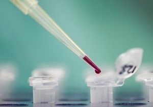 analyticchem's tweet image. Track 20-3 #MultipleReactionMonitoring
#Proteomics #QuantitativeProteomics #PlasmaProteomics #ProteotypicPeptides #ClinicalAnalyses #NanoElectrosprayIonization 

For Topics/Tracks: analyticalchemistry.euroscicon.com