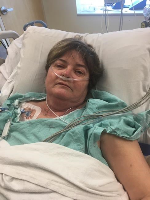 Lungs from hepatitis C-infected donors can be safely transplanted: researchers: bit.ly/2JTfIvG https://t.co/uO8MAkpuJq