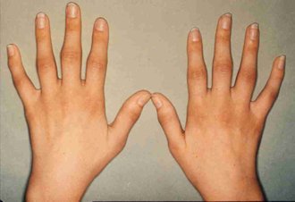 physioinS8's tweet photo. Open for a surprisingly good ‘core’ exercise - https://t.co/ttCUY76m4Q https://t.co/WB0XrPXevg