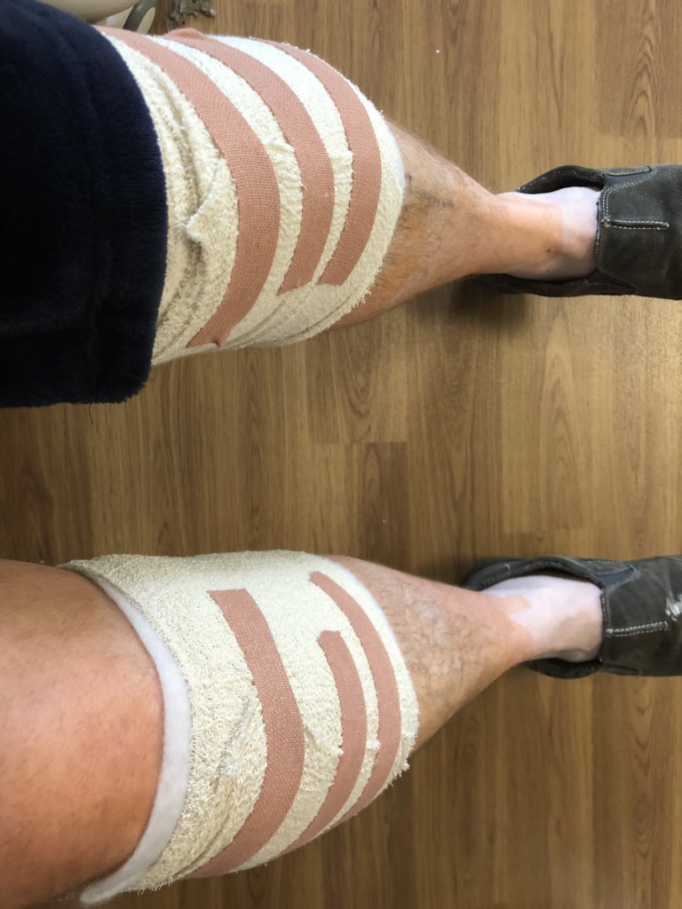 mnoble81's tweet photo. Operation all done. Just waiting to be allowed to go home now. https://t.co/wjNzyR6kst