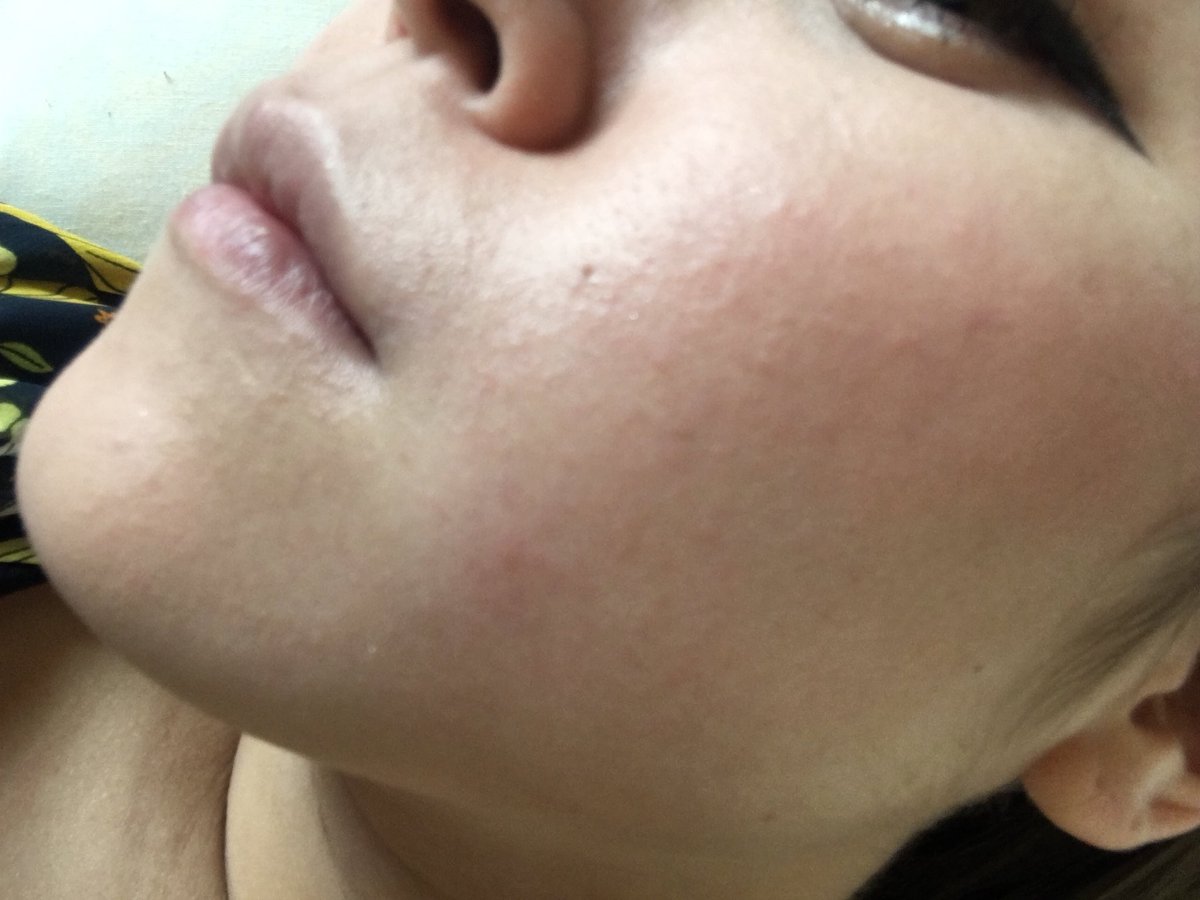 Sagiri さいちゃん على تويتر 本当に肌綺麗になった このコスパで 高級化粧品に 匹敵する力があるなら 最強 肌綺麗になりたい人見てみて T Co Ryntgzw4th