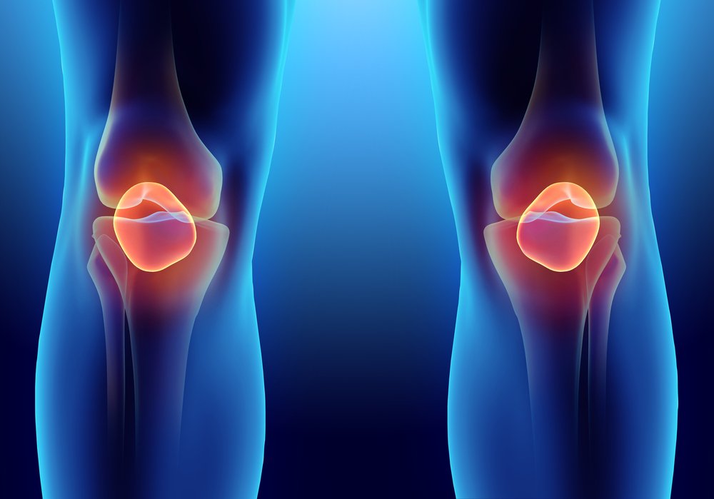 DrNikhilVerma's tweet photo. Lateral #patellarinstability is almost always caused by a #kneecapdislocation during a traumatic event or sports activity. https://t.co/AFl4pY82hy https://t.co/fNdfXSj5gx