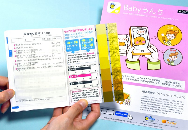 胆道閉鎖症 Twitter Search Twitter