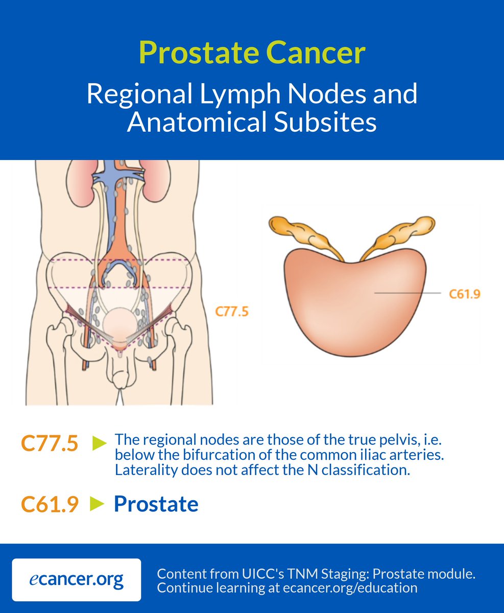 Prostate cancer abdominal lymph nodes, Prostate cancer abdominal lymph nodes - grandordeluxe.ro