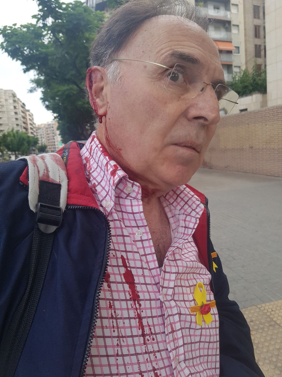 MareaMpll's tweet photo. El Josep ha estat agredit avui dia 15 de juny a les 07.00 a la plaça Ricard Vinyes.
Els agressors eren persones que es dedicaven a treure cartells del carrer.
Durant el dia d'avui anirà a presentar la corresponent denúncia al Mossos. https://t.co/1ohCUXRzxz