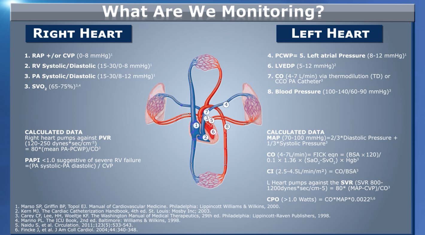 Protected Pci Drs Shelleyhallmd And Ajaysmd Discuss The Use Pa Catheters To Monitor Hemodynamics Tune In To Watch The Short Webinar T Co Xecyyrrrvj T Co Ayqdeao9ky Protected Pci Drs Shelleyhallmd And Ajaysmd Discuss The Use Pa Catheters To Monitor Hemodynamics Tune In To Watch The Short Webinar T Co Xecyyrrrvj T Co Ayqdeao9ky