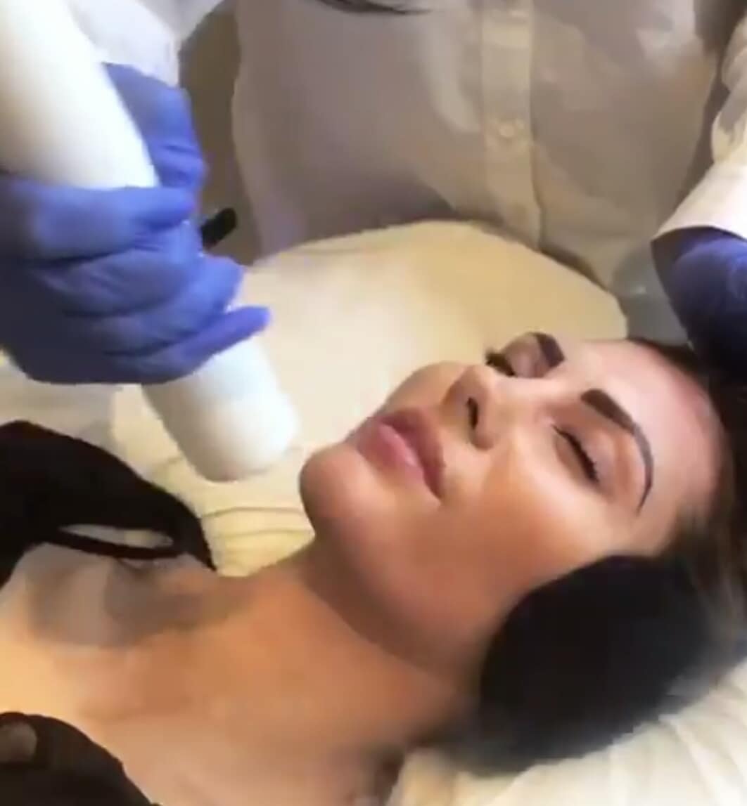Beautiful&amp;talented <a href="/charlizeberg/">Charlize Berg</a>  Experienced our facial by Cryo ❄❄❄ 
📞 to Book 0794075196 
Or email: info@cryoniqsa.com
#Cryotherapy 
#Facial #Pretoria #Southafrica #Beauty #Skincare #Glow #Weddings #dermapen
#Beauticians #Salon #aesthetics #peels #microneedling