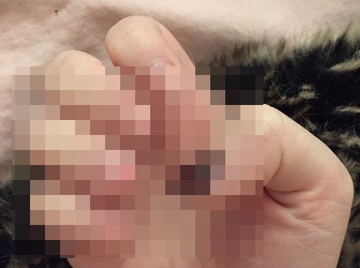 TikaiLabakais's tweet photo. ŠĀDA ir realitāte pēc ilgstošu akrila nagu "nēsāšanas" - veči, labi, ka mums tādus nevajag! (FOTO) | https://t.co/iVfFRNyxDp https://t.co/fDE8WkmD6Q