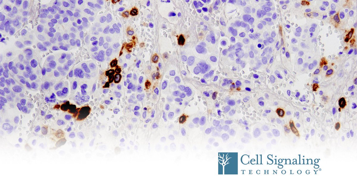 CellSignal's tweet photo. 😷Unmask tumor-associated myeloid cells, such as macrophages (TAMs), dendritic cells (TADCs), and danger-associated molecular patterns (DAMPs) with TIM-4 (D3W4F) XP® Rabbit mAb validated in IHC, Flow, and WB.
https://t.co/Ee9Lz1pAaC
#ImmuneCheckpoint #myeloid #TIM4 https://t.co/7ay4nzWUdP