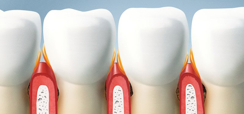 Periowave_mx's tweet photo. ¿Cómo sé si tengo enfermedad de las encías?
Los síntomas de la enfermedad de las encías incluyen:
Mal aliento constante
Encías rojas o inflamadas
Encías muy sensibles o que sangran
Dolor al masticar
https://t.co/8d20S9HRVH https://t.co/hWKUhhlaqG