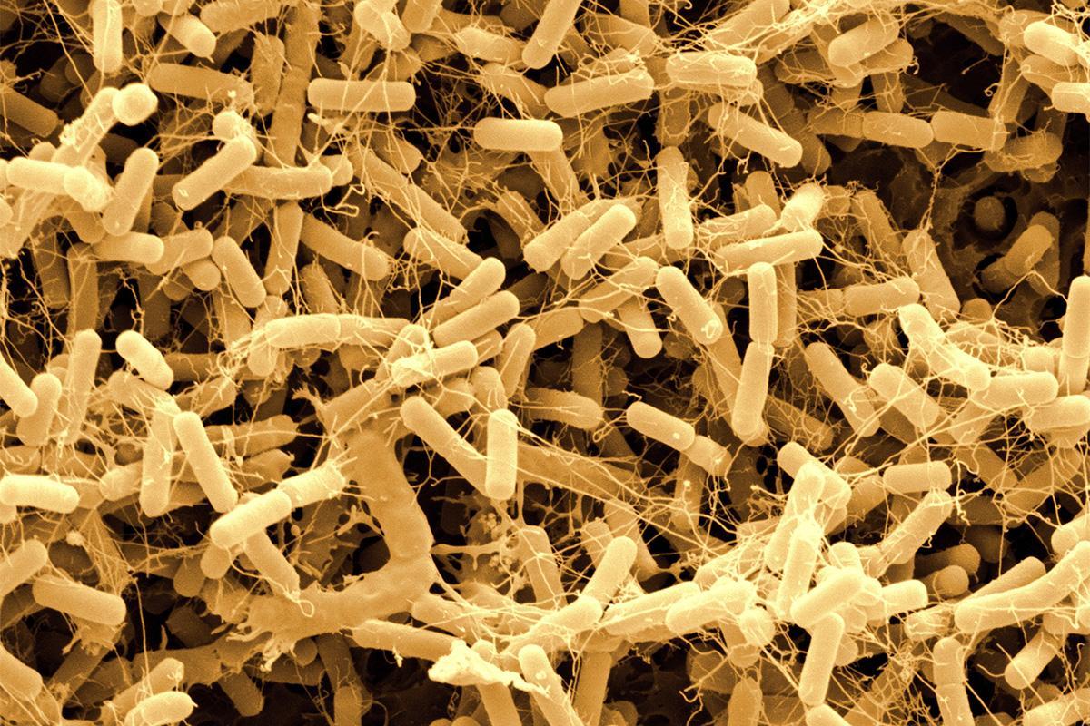 гниль ядровая заболонная. редуценты микроорганизмы. лишайники паразиты. пестрая ситовая гниль. лепрозные лишайники.