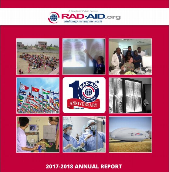 RADAIDIntl's tweet photo. #RadAidIntl works in 28 countries to improve &amp; optimize their #Radiology service, with over 9,000 volunteers serving more than 40m people. Check out our annual report https://t.co/SeyZvfGjgo #GlobalRad https://t.co/h8Qmf2b6zg