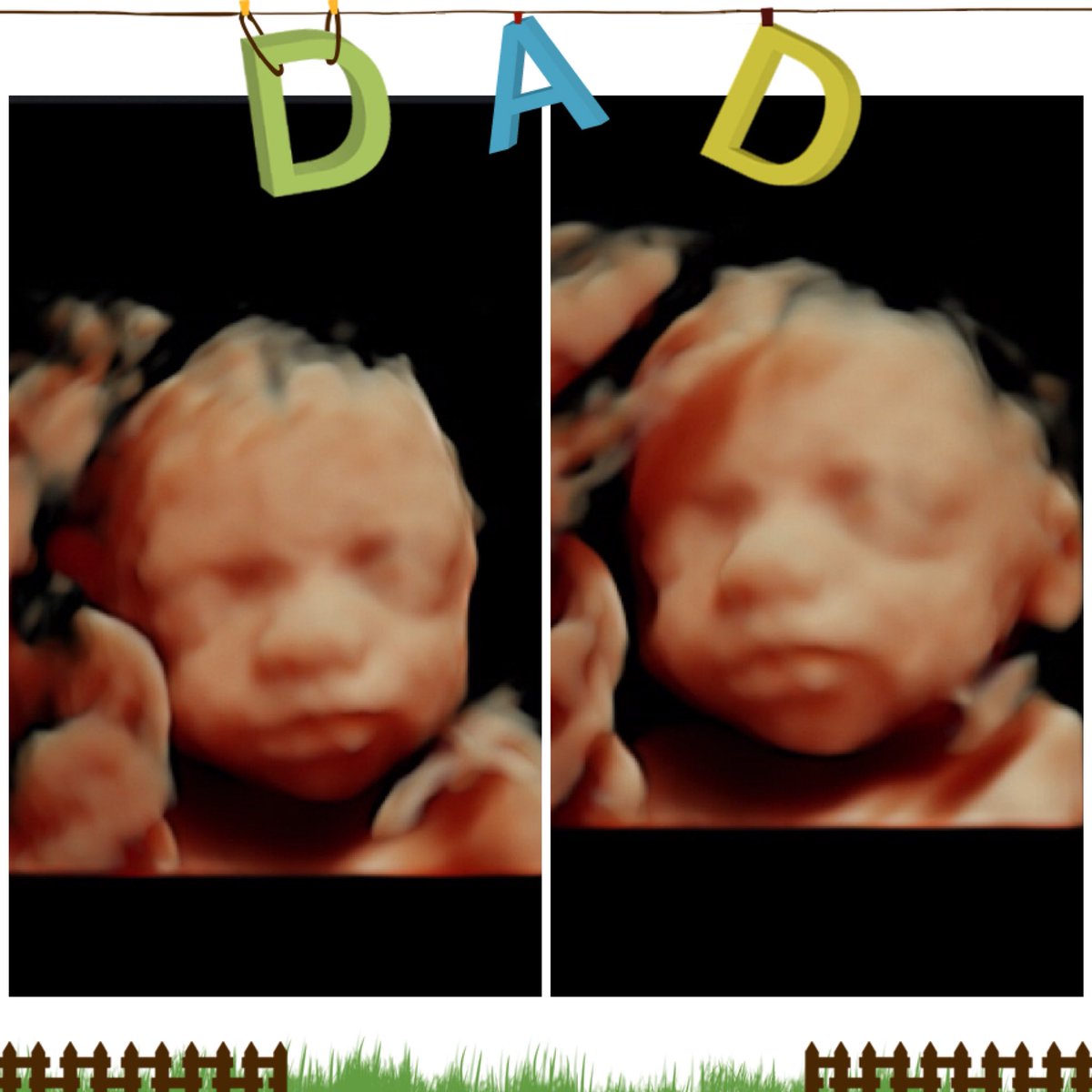baby_dimensions's tweet photo. I hope all of you ladies have a big plan for Sunday, it is #Father’sDay. We’ll be open, in case you wanted to surprise #Dad and see #3D and #HDImaging if the Baby. Continue drinking 5 bottles of water every day or more so you have some great fluid.  #babydimensions.com https://t.co/FbeC3q37Ps