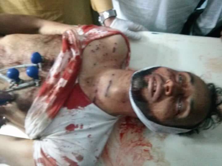 MirwaizKashmir's tweet photo. Deeply saddened by the news that we have lost another youth Sheeraz Ahmed shot dead by forces in Anantnag.Even on #Eid Kashmiri’s are not spared the bullet! Killing by forces continues unabated with impunity&amp; without remorse.Urge international community to take note &amp;act urgently https://t.co/GJjYVJJLq3
