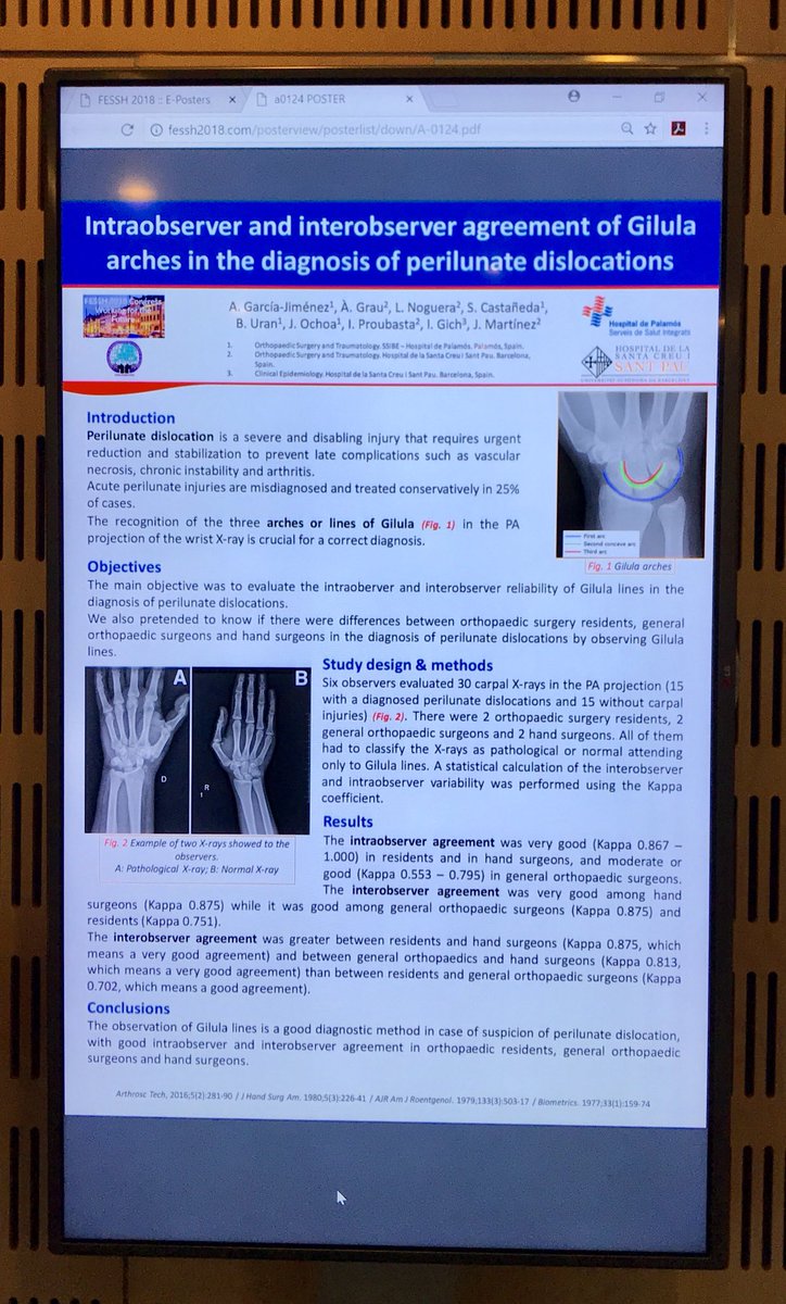 DrGarciaJimenez's tweet photo. No todo ha sido aprender y visitar Copenhague, también hemos presentado en la #FESSH2018 (aunque sólo haya sido un póster...) @RecercaSSIBE @HospitalSantPau @FESSHEurope https://t.co/BvLLroB8PW
