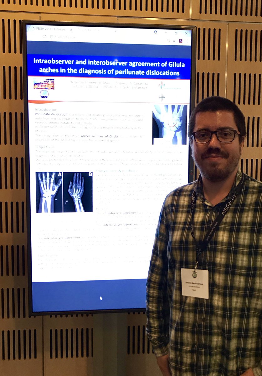 DrGarciaJimenez's tweet photo. No todo ha sido aprender y visitar Copenhague, también hemos presentado en la #FESSH2018 (aunque sólo haya sido un póster...) @RecercaSSIBE @HospitalSantPau @FESSHEurope https://t.co/BvLLroB8PW