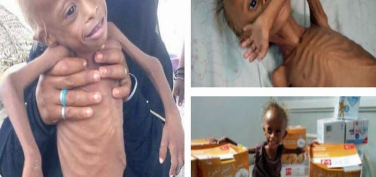 DfzxXYEWAAALzRr.jpg:large