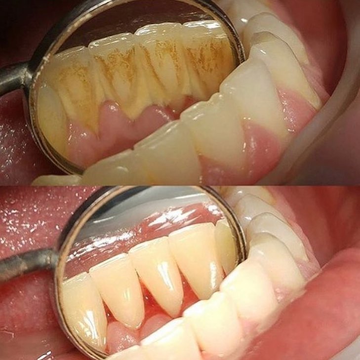 HowardFarran's tweet image. Ignore your teeth and they’ll go away. When was the last time you had your teeth cleaned?