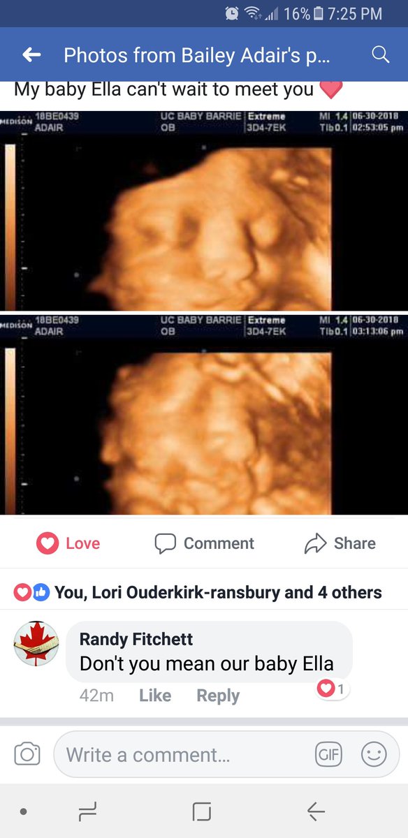 4D pic of my granddaughter Ella. Looking forward to holding you