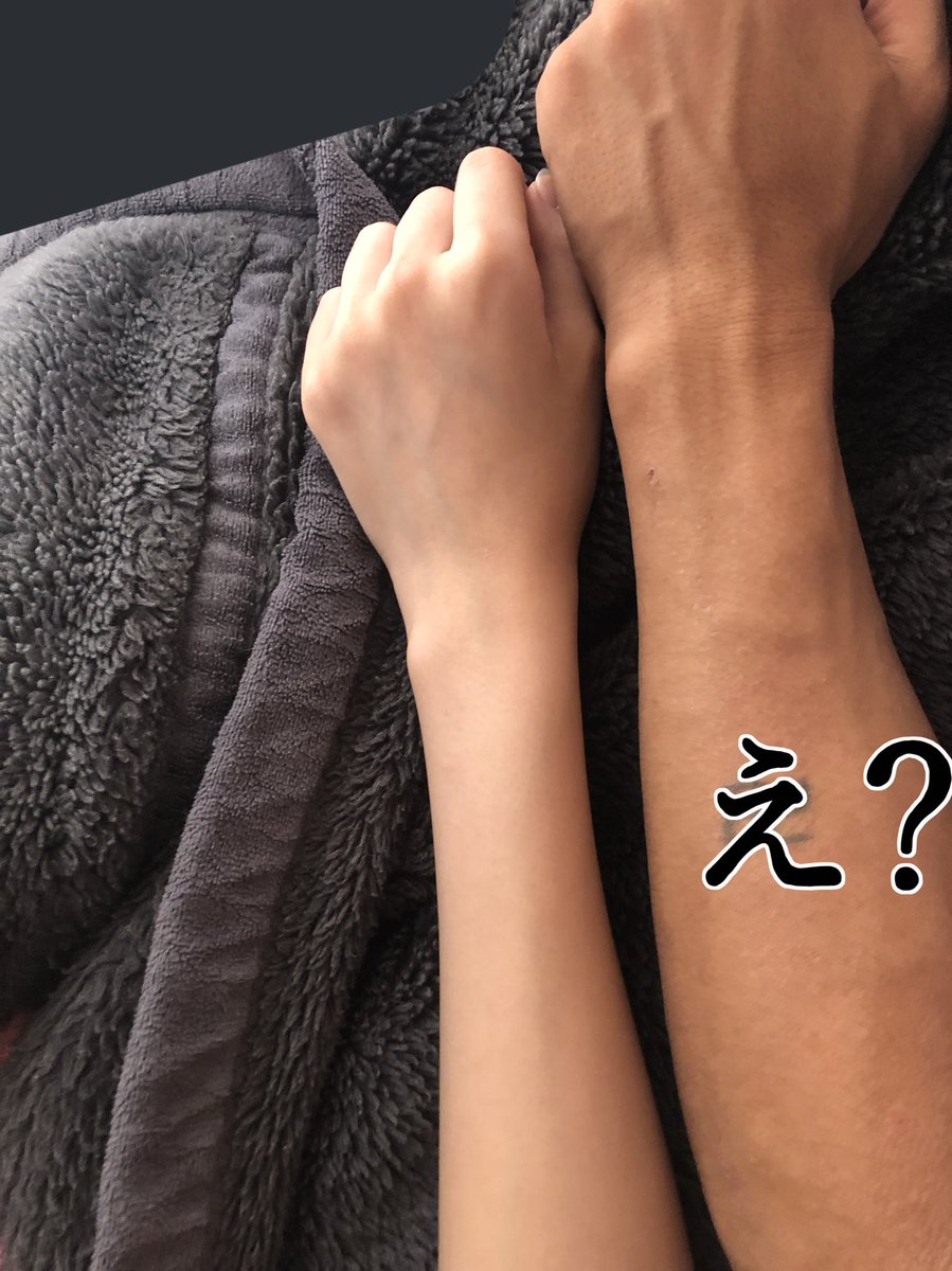 HgmRyuki's tweet photo. まなかの腕の棒やん爆笑
肌の色も白いし笑笑
こんなんどっかぶつけたら絶対すぐ折れるよな爆笑 https://t.co/iAuAS2zgWw