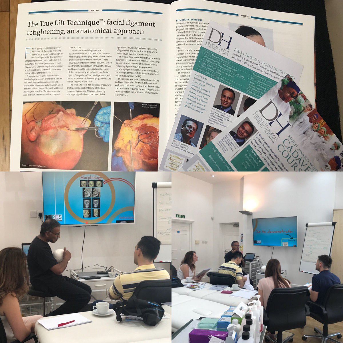 mdhtraining's tweet image. Another #multiawardwinning #midface #lowerface #injectabletraining well underway at @WigmoreMedical demonstrating techniques with sound anatomical basis #publishedauthors #qualifiedanatomists @PMFAJournal @pdsurgery @Anna32Baker @mdhtraining dhaesthetictraining.org 👍🏻
