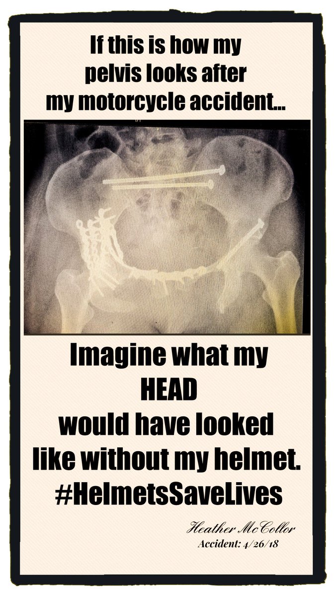 PhoenixServices's tweet image. My name is Heather. I'm responsible for managing social media for Phoenix. On 4/26/18, I was riding my Harley when truck failed to yield right-of-way and I T-boned him at 50 mph. My body is broken, but thx to my gear I survived, &amp;amp; I don't have a TBI. Please, always wear a helmet.