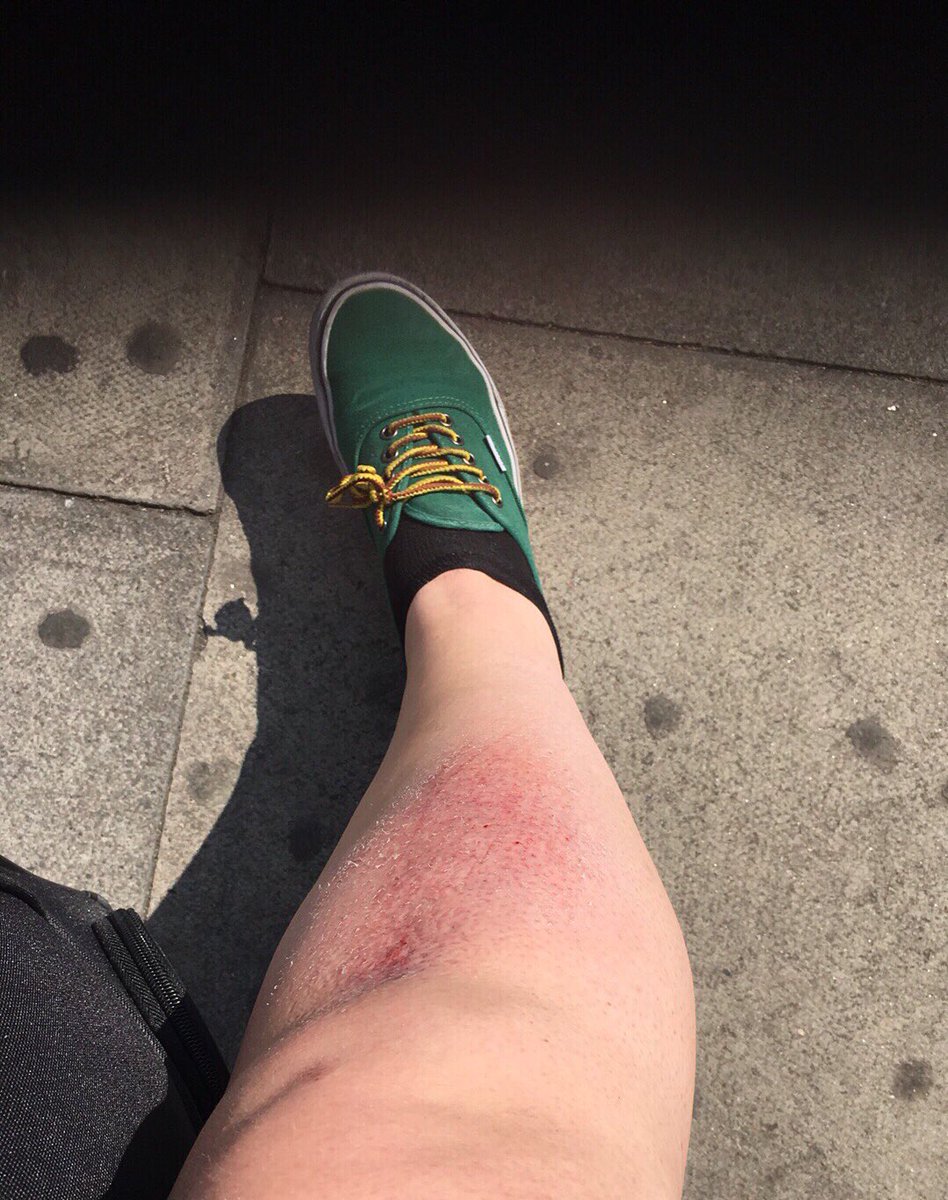 ann_perla's tweet photo. The pavement and I had a disagreement. I lost. #fml #fallingoveryourfeet #justoneofthosedays #Embarrassing #lol https://t.co/H2i2uAV1fb